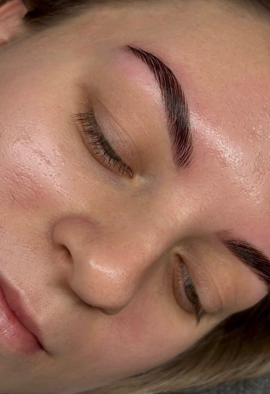 Brow lift rezultat — NoFilter Osijek